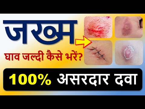 "1 दवा – घाव से छुटकारा!" "जख्म भरने की सबसे बेस्ट दवा!"
