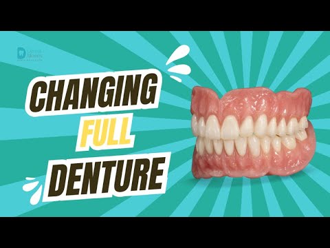 Changing full denture