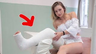 My Sister Broke My Leg! Life with Leg in Plaster Cast - Part I  