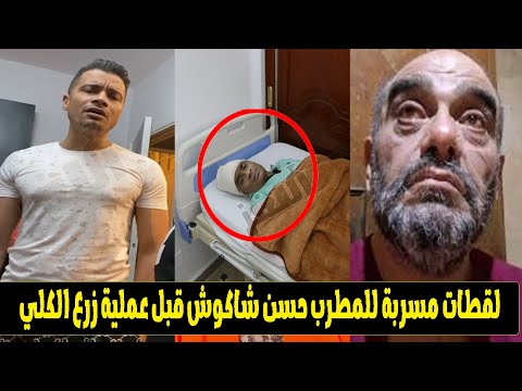 الحقيقية الكاملة لسـ ـرقة أعضـ ـاء تيكتوكر شهير لإنقاذ المطرب حسن شاكوش من المـ ـوت