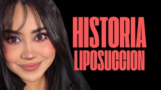 Mi HISTORIA CON LA LIPO 😭 Miku