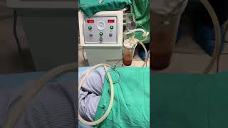 vaser liposuction by Dr. Suyog Mainali