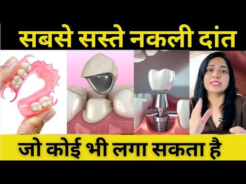 सबसे सस्ते और अच्छे नकली दांत कौनसे होते है ? Removable Partial Denture | Cheapest Artificial Teeth