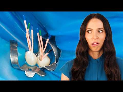 What's REALLY Happening During A Root Canal?