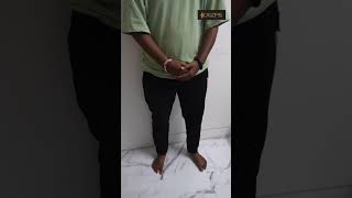 Keyhole FTM top Surgery result