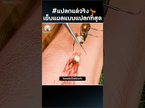 เย็บแผลแบบแปลกที่สุด 🐜 😱 #แปลกแต่จริง #funfacts #shorts