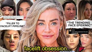 EVERYONE GOT FILLER… NOW THEY NEED FACELIFTS
