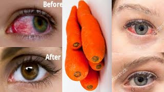 How to improve your eyesight naturally in 3 days how to correct bad eyesight fast