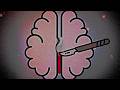 Understanding Split-Brain Phenomenon