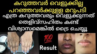 വെറും ഉരുളകിഴങ്ങ് മതി എത്ര കറുത്ത മുഖവും വെളുപ്പിക്കാം /potato facepack/#viral