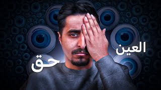 العين حق !!