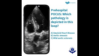 Which pathology is depicted in this loop?