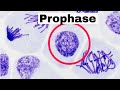Understanding Prophase in Mitosis