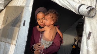 الرضيع أدهم أبو عرمانة يعيش حياة صعبة في مخيم النصيرات وسط قطاع غزة حيث لا غذاء ولا دواء