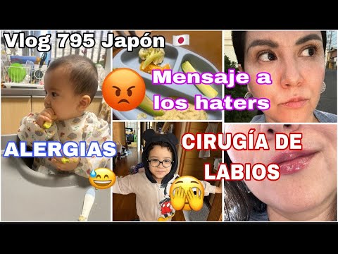 🇯🇵Mensaje a mis Hat3rs🤯+ALERGIAS 😱+ Cirugía de LABIOS 😅 + Dimelo en mi cara 🥺+ Educar desde la CALMA