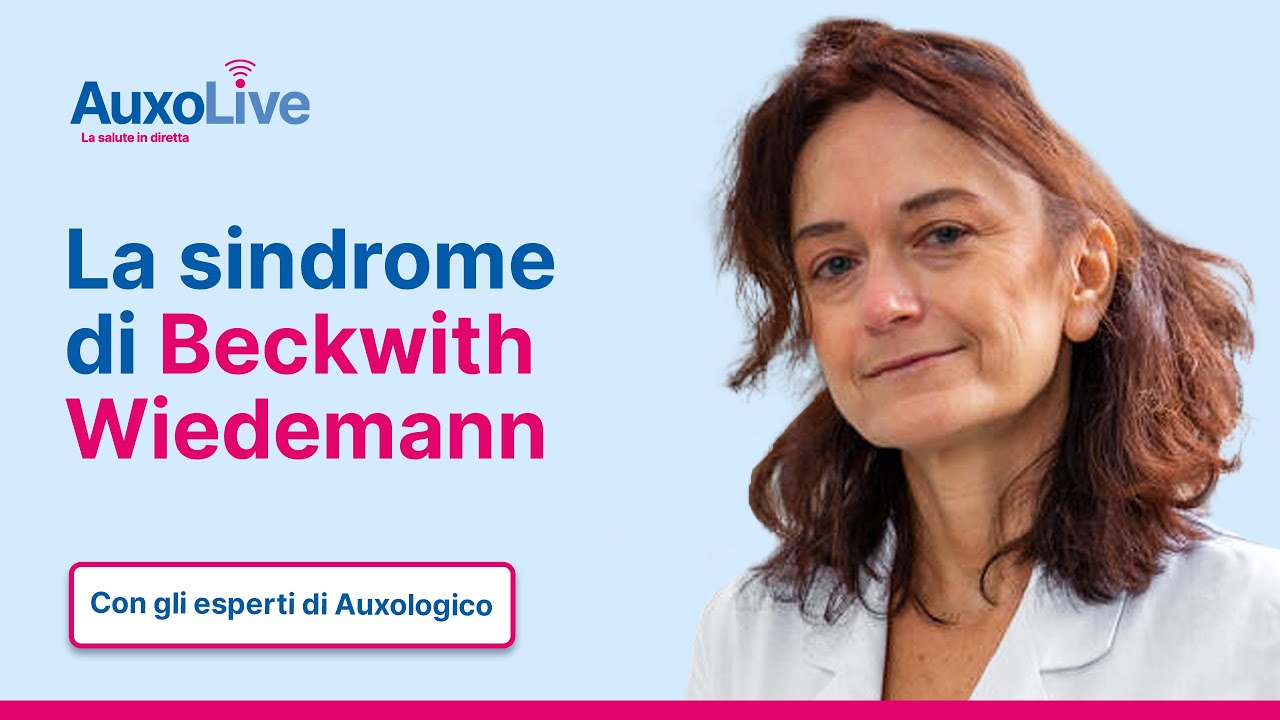 Sindrome di Beckwith-Wiedemann: esperienze e sintomi