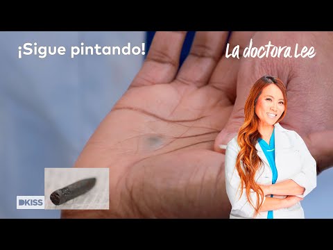 Extrae una mina de lápiz de la mano después de 45 años… ¡y sigue pintando! | La doctora Lee