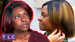 Depresyona Sokan Yumrular | Doktor Çıbanım - Dr. Pimple Popper
