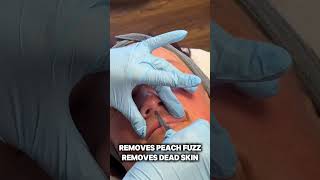 Get SOFT & SMOOTH Skin With DERMAPLANING! #skincare #beauty #shorts