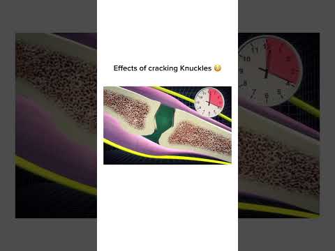 Cracking knuckles #shorts #trending #viralshorts #explore #facts #ytshorts