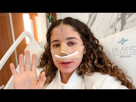 Vlog: FIZ RINOPLASTIA! 😱