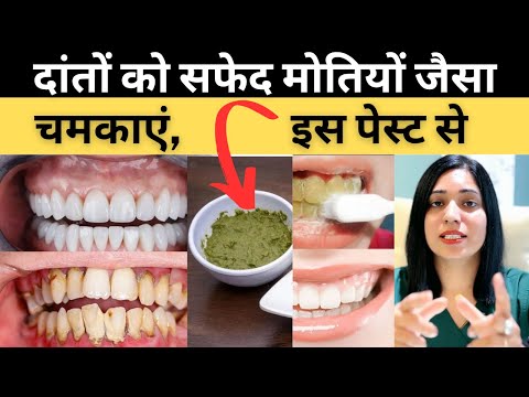 दांतो को मोतियों की तरह सफ़ेद चमकाने का बेस्ट घरेलु पेस्ट | Teeth Whitening Paste At Home |