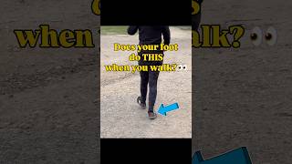 Does your foot roll inward when you walk? 👀