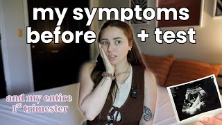 All My Pregnancy Symptoms in The 1st Trimester 🤰🦋