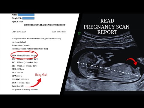 Third Trimester Pregnancy Ultrasound Reporting 💕Obstetric Ultrasound Scan Report Baby Girl