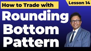 Rounding bottom Pattern | Rounding bottom Chart Pattern |