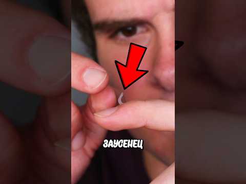 Никогда Не Отрывайте Заусениц! 😱