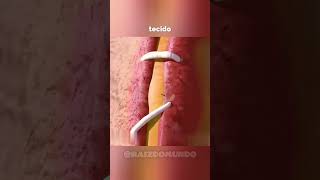 ASSIM É O PROCESSO DE CICATRIZAÇÃO #shorts #viralshorts #fatoscuriosos #saúde #corpohumano