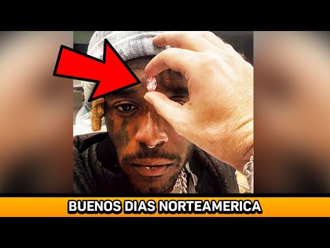 SE INCRUSTÓ UN DIAMANTE 😱😨
