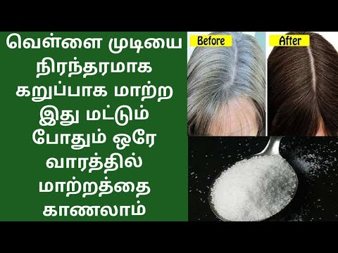 வெள்ளை முடியை நிரந்தரமாக கறுப்பாக மாற்ற இது மட்டும் போதும் ஒரேவாரத்தில் மாற்றத்தை காணலாம் #tips #new