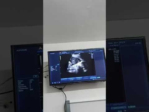 25 Maret 2021
