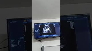 25 Maret 2021