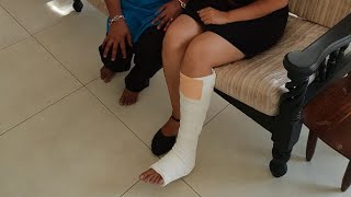 Leg Cast Trip to Aliya Resort Sigiriya and Wheelchair Bound
