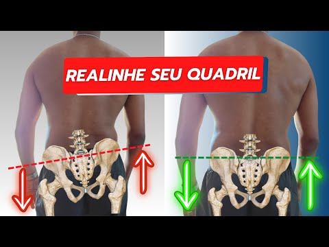 Quadril Desalinhado? Veja Como Corrigir em Casa com Exercícios Simples e Eficazes!