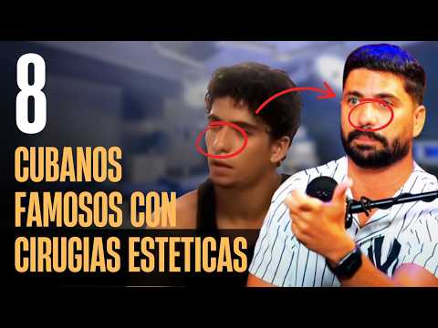 8 Famosos Cubanos que se Han Hecho Cirugías Estéticas 😱 | ¡Antes y Después!