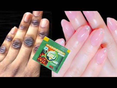 Hand whitening secret cream at home | Hand whitening tips | permanently Hand whitening cream