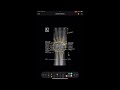 Wrist Imaging Techniques and Challenges
