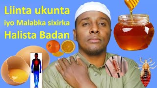 Sixir Liin malab iyo ukun Lagu sameeyo Halista Qarsoon kaaga Digayaa sidaan ma isku aragtay