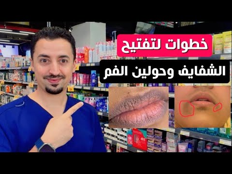 تخلصي من اسمرار حول الفم والشفايف نهائيًا