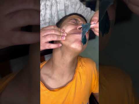 مواقف حلاقه 😂 تنظيف الفك 😱✂️#subscribe #barbershop #viralyoutubeshorts #تحشي #كوميديات