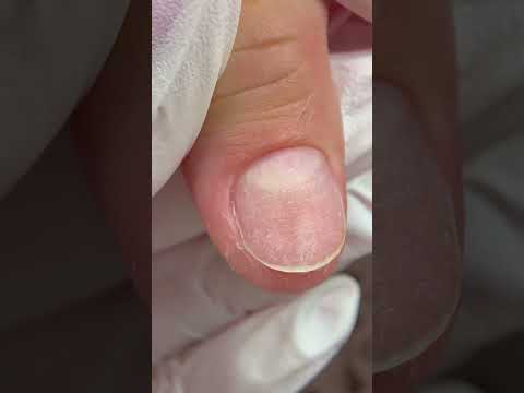 Unghie trasformazione #unghie #nails #nailart