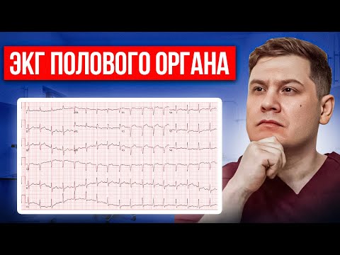 ЭКГ полового органа это реально? Личный опыт пациента и мнение уролога!