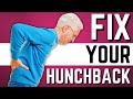 Preventing and Treating Hunched Back