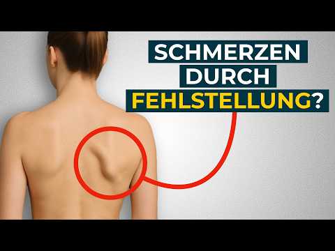 Abstehende Schulterblätter wegtrainieren (Scapula alata)