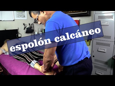 Espolón Calcáneo