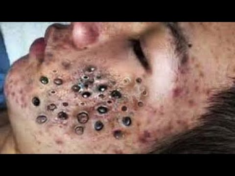 طرق حماية بشرة الوجهCC335